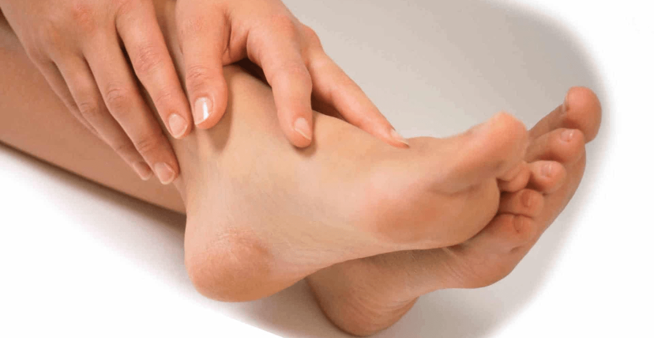 Infecția fungică poate afecta pielea dintre degetele de la picioare