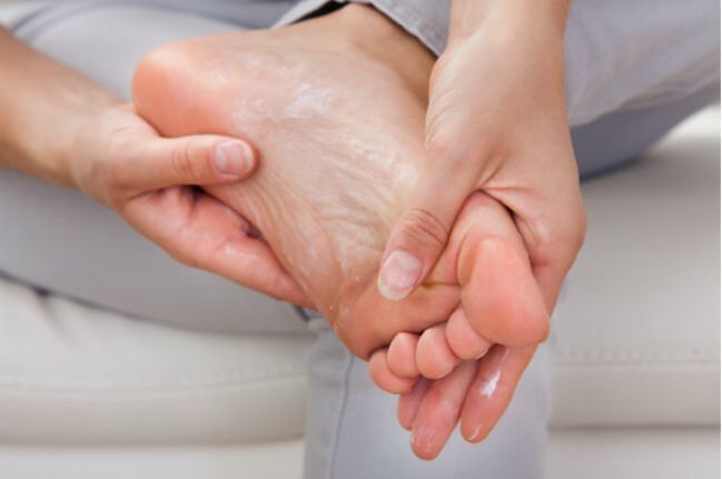 Cremele și picăturile antifungice vor ajuta în stadiile inițiale ale ciupercii unghiilor de la picioare
