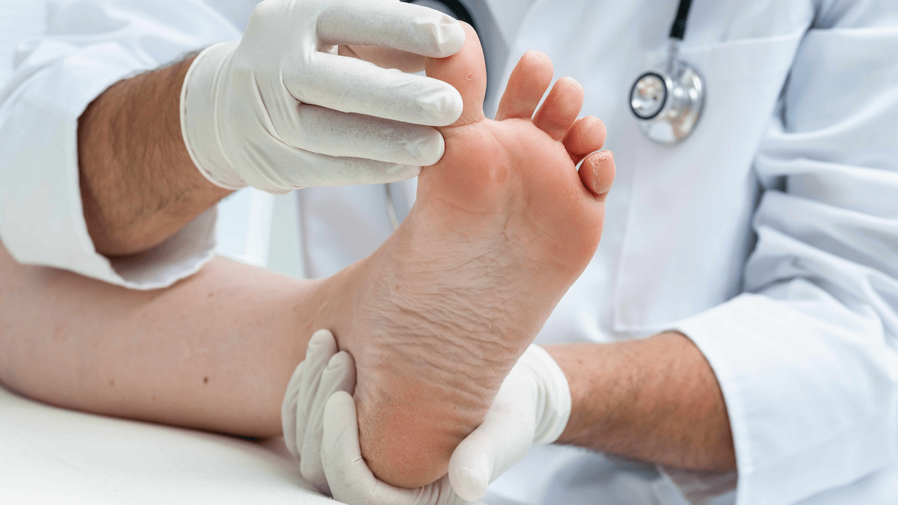 examinarea pielii picioarelor la o programare cu un specialist
