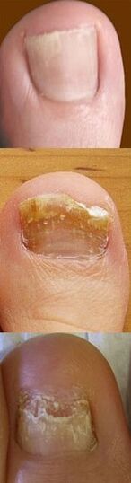 Forme ale ciupercii