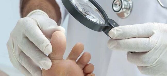 Examinări înainte de începerea tratamentului fungic