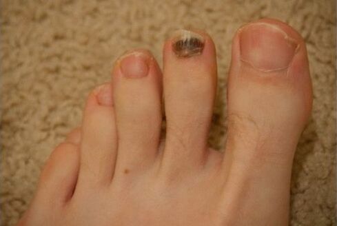 Utilizarea medicamentelor orale și topice