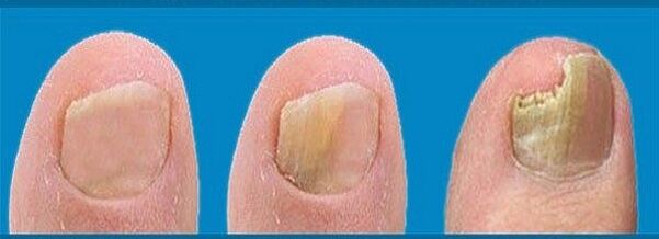 procesul de dezvoltare a ciupercilor